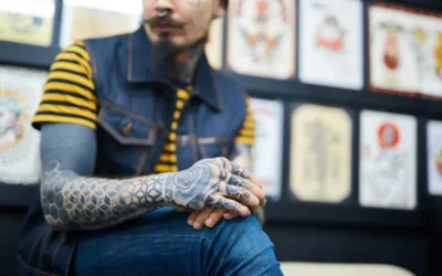 Answering 3 FAQs About Laser Tattoo Removal