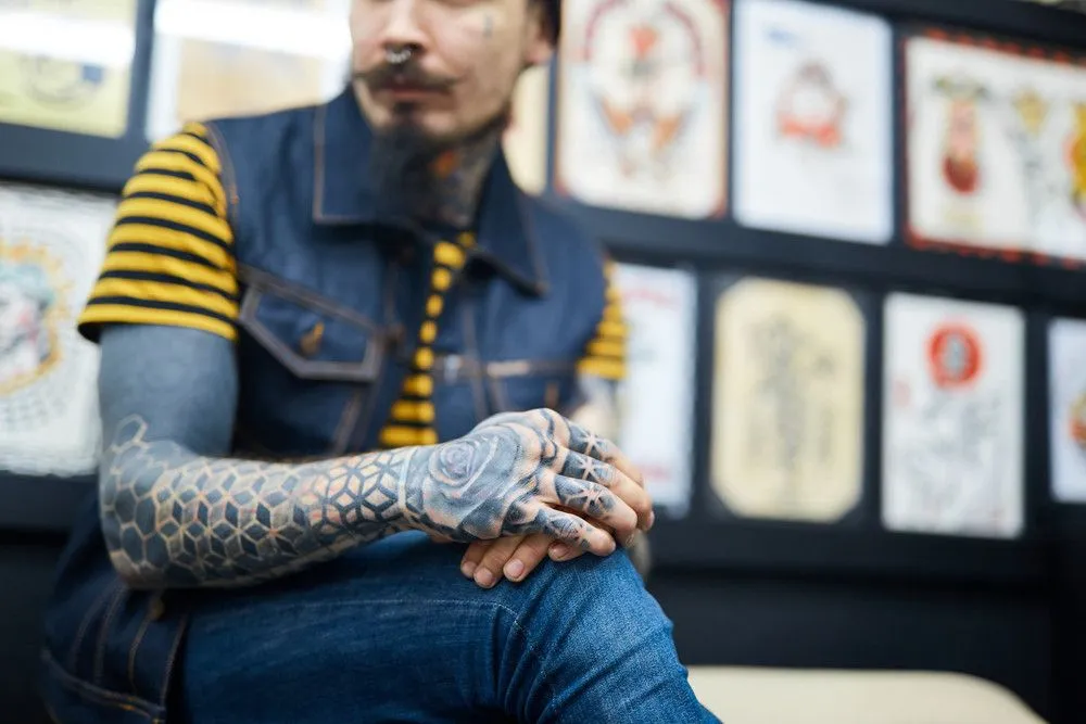 Answering 3 FAQs About Laser Tattoo Removal