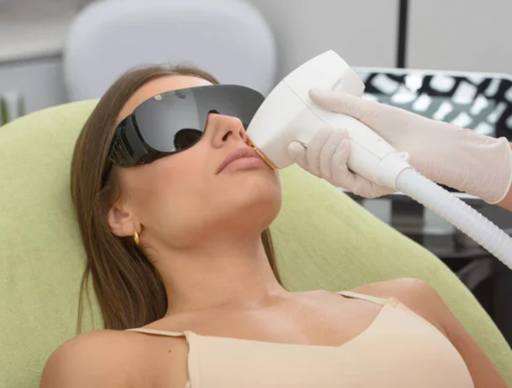Depilación láser facial (1)