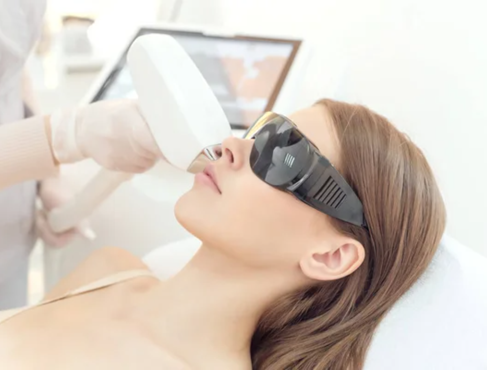 Depilación láser facial (4)