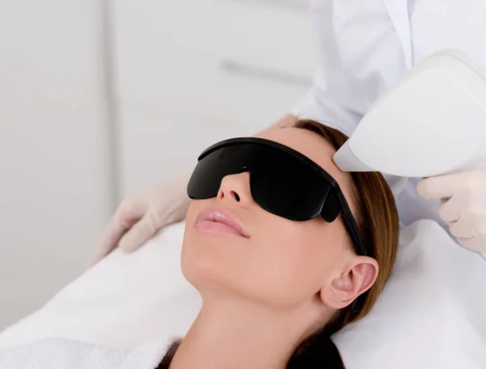 Depilación láser facial (4)