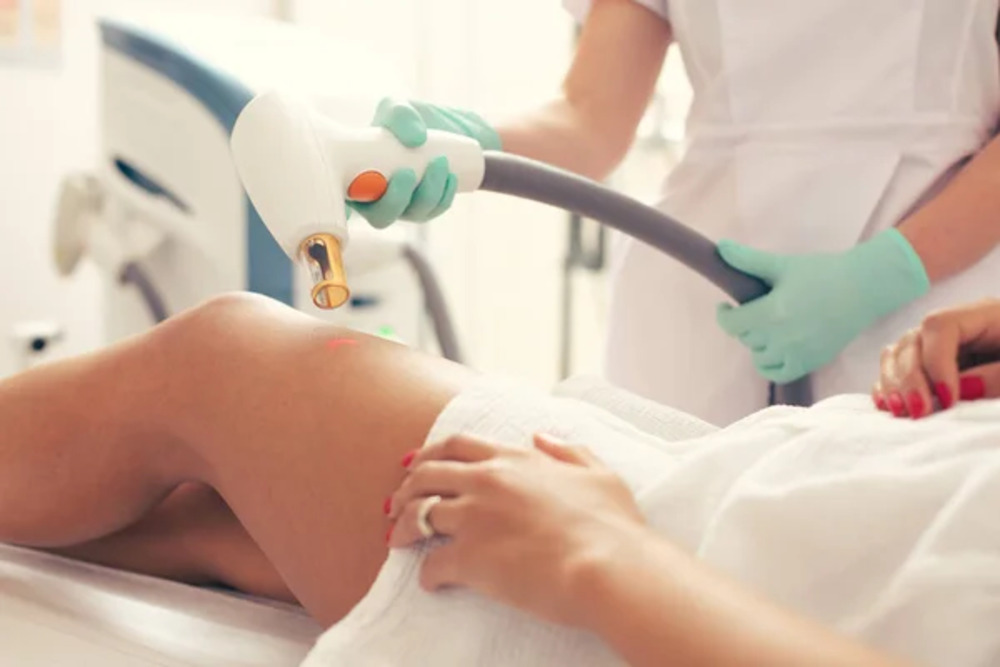 Laser Hair Removal
