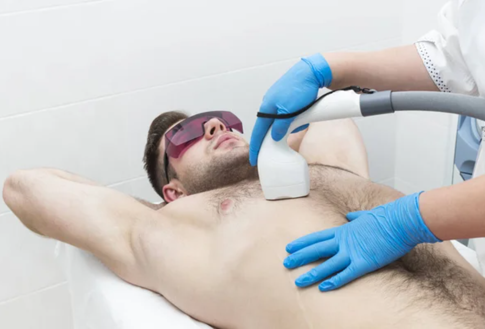 Laser Hair Removal for Men