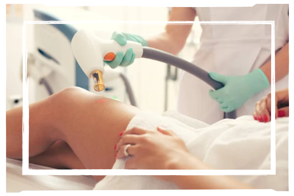 Laser Hair Removal