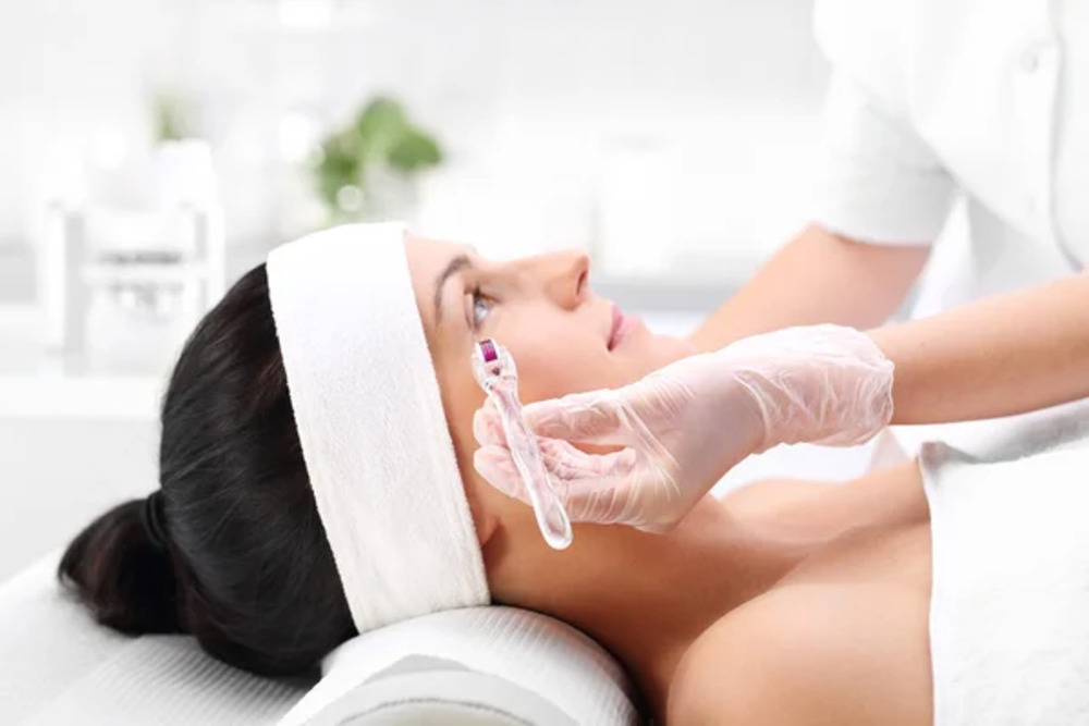 Microneedling