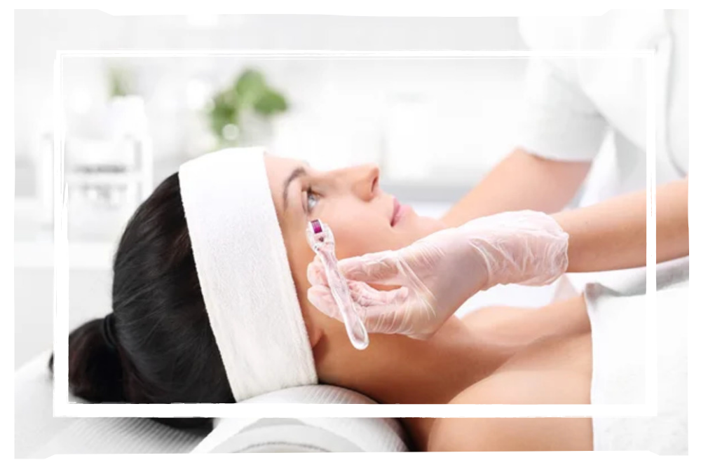 Microneedling