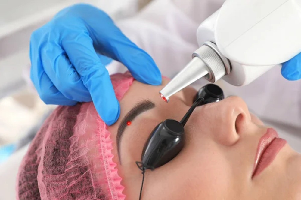 Eliminación de maquillaje permanente 1
