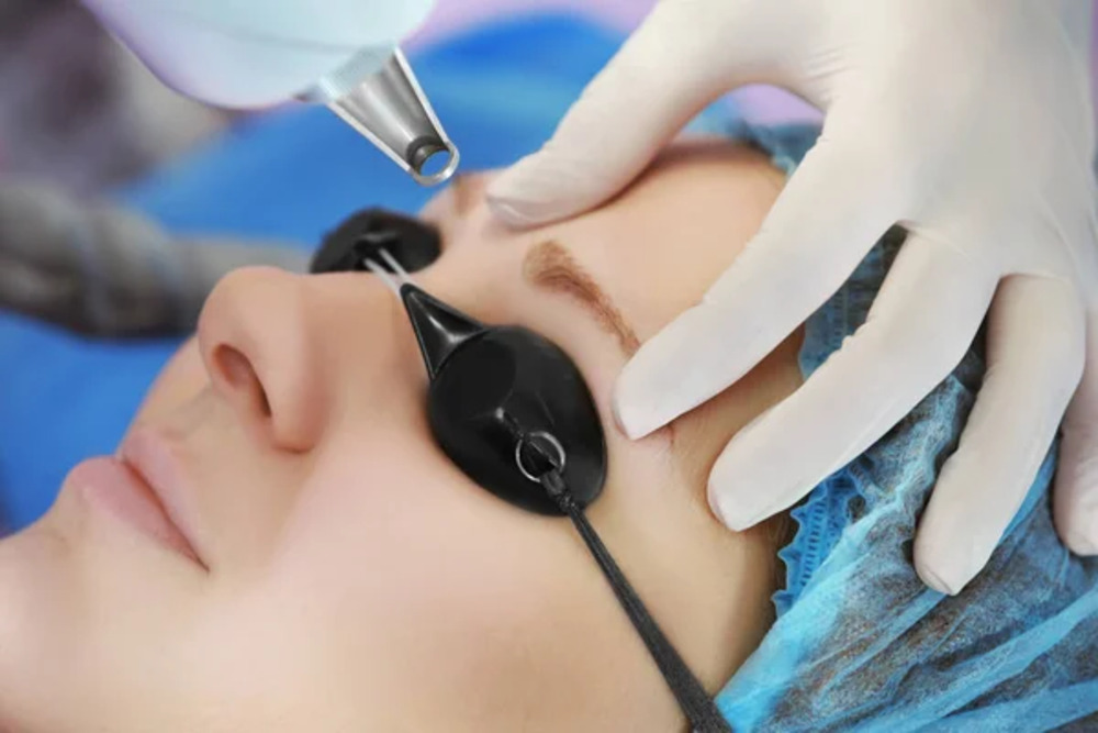 Eliminación de maquillaje permanente 2