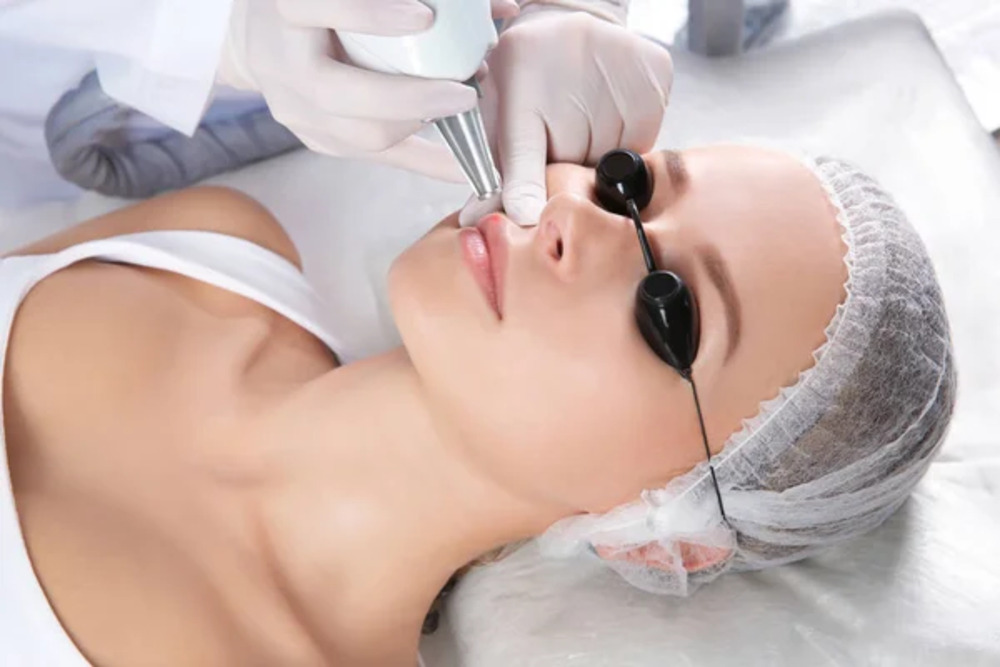 Eliminación de maquillaje permanente 3