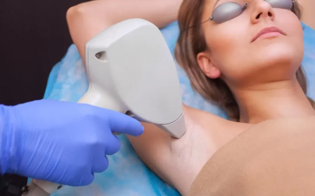 5 Myths About Laser Hair Removal