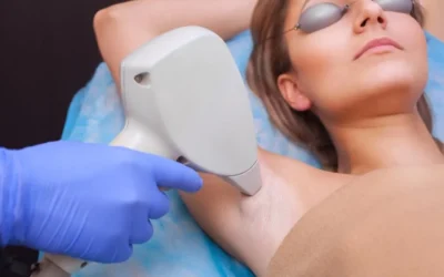 5 Myths About Laser Hair Removal