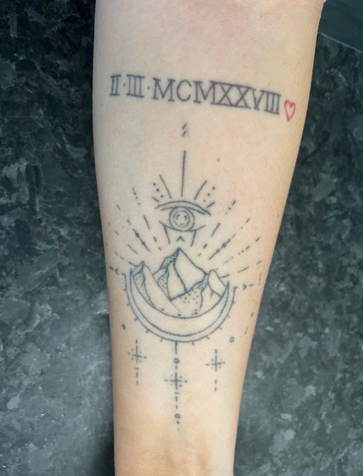 Tattoo before removal treatment at Knue Laser